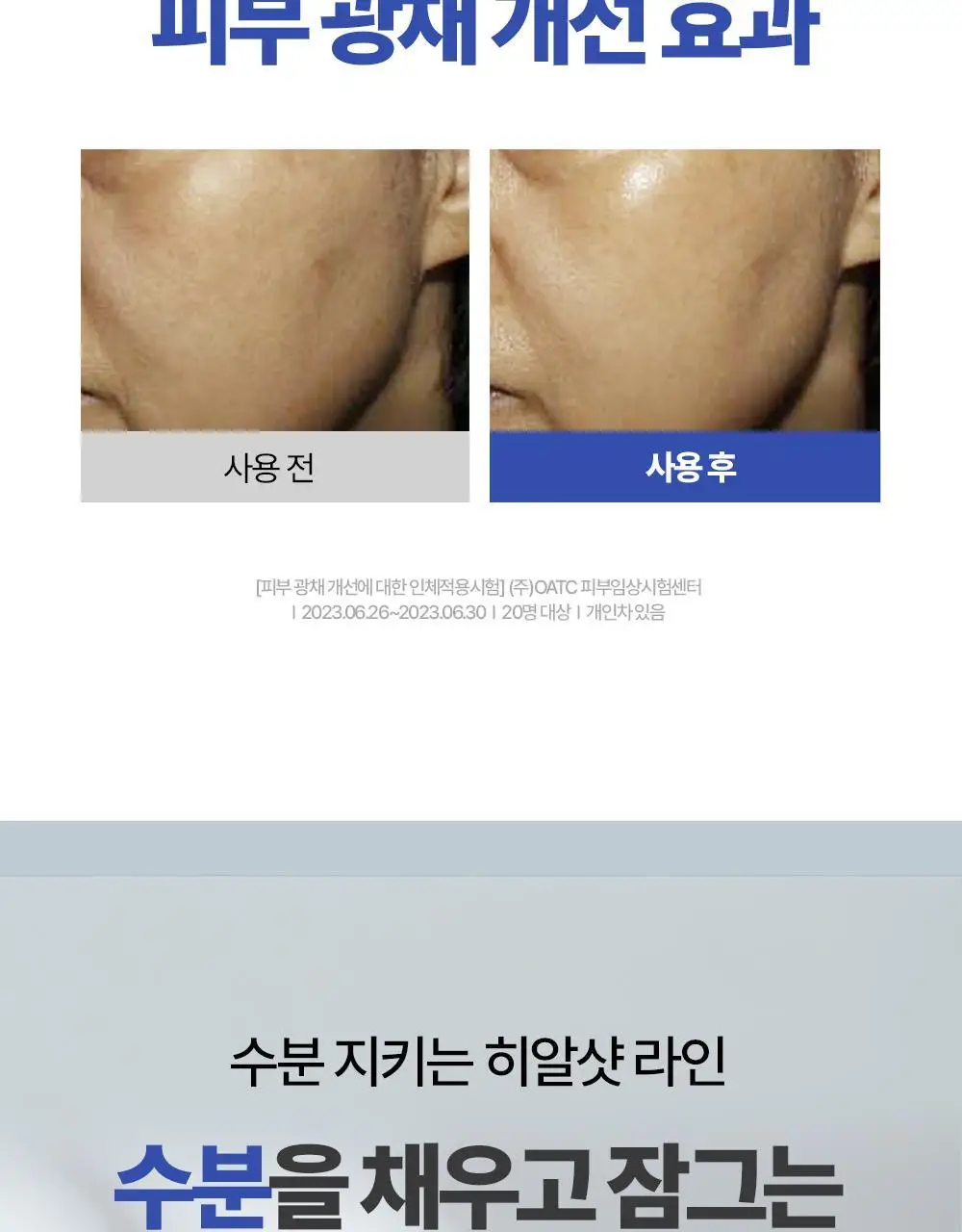 [아기맹수Pick/1+1리필기획] 더마토리 히알샷 베리어 B5 앰플 50ml 리필기획(+50ml 리필) 상세페이지 27